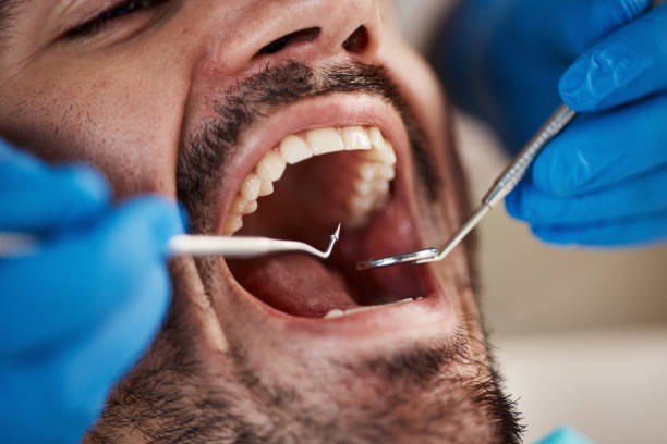 Best Emergency Dental Care for Broken or Chipped Teeth in Wlowbrook, IL