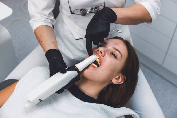 Best Emergency Wisdom Teeth Removal in Wlowbrook, IL