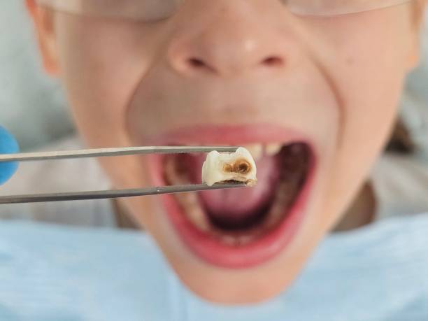 Best Emergency Orthodontic Services in Wlowbrook, IL